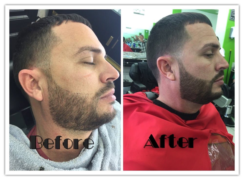 Before and after beard and fade